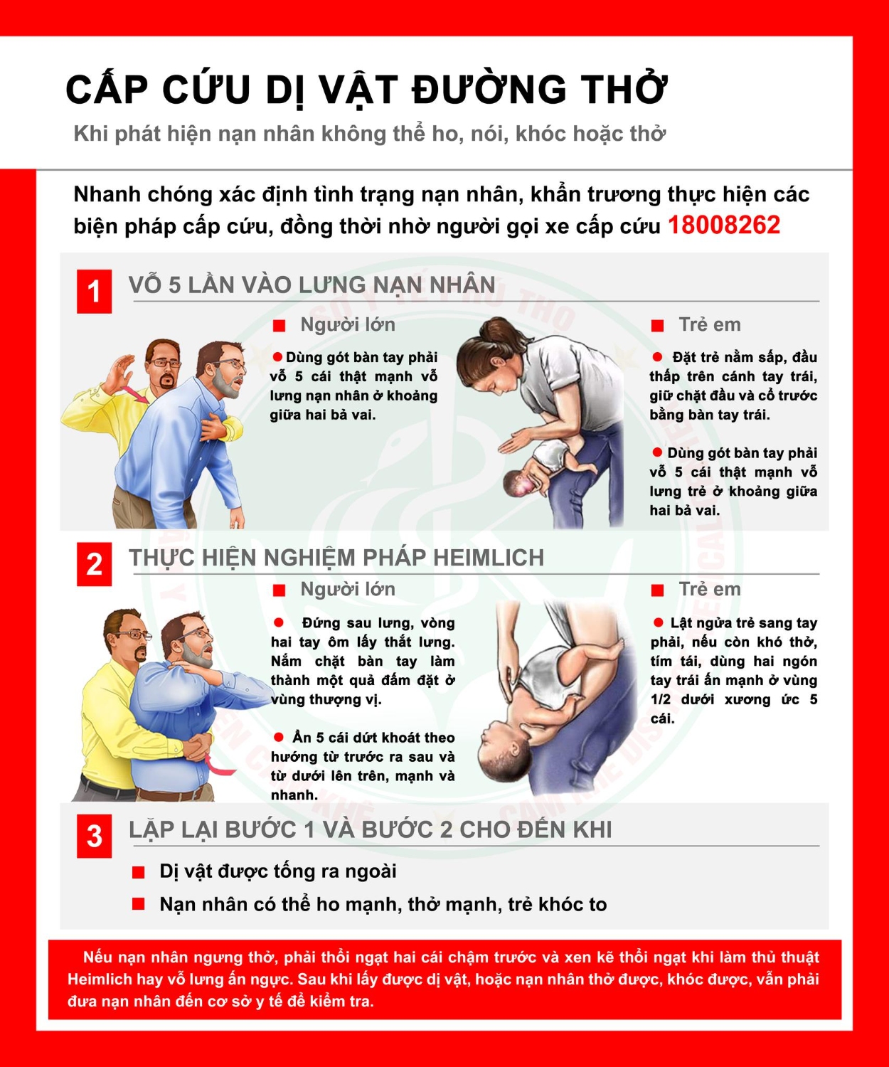 Cấp cứu dị vật đường thở