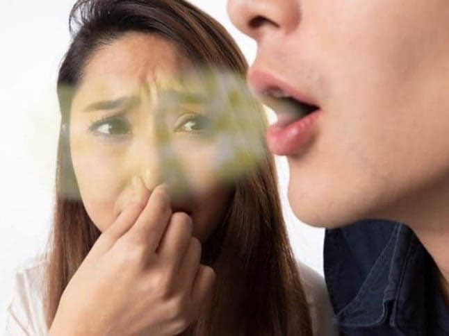bị hôi miệng