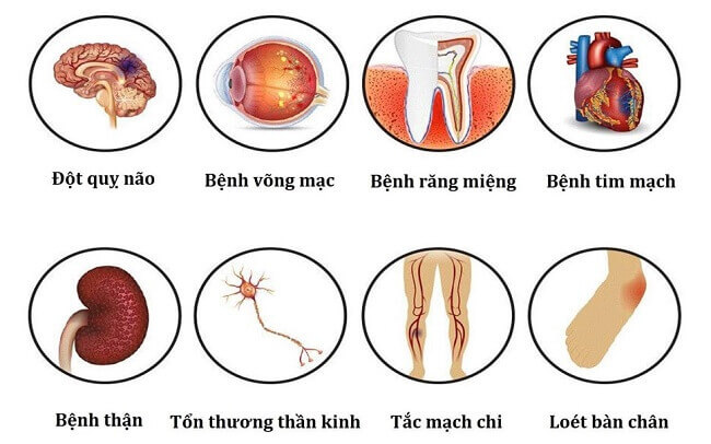 bien chung tieu duong 1