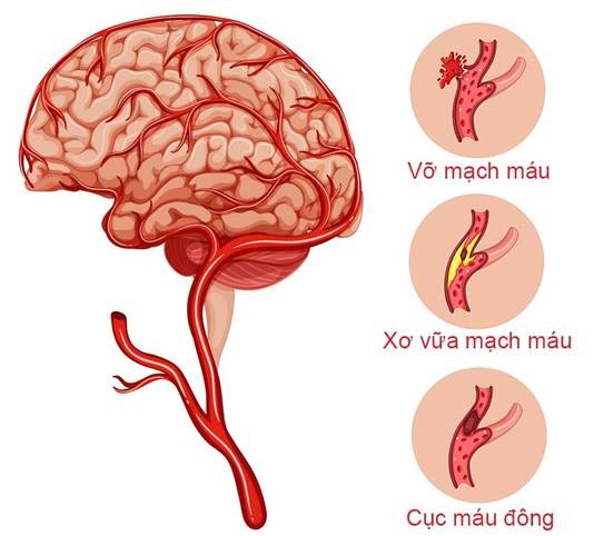 dot quy nhoi mau nao