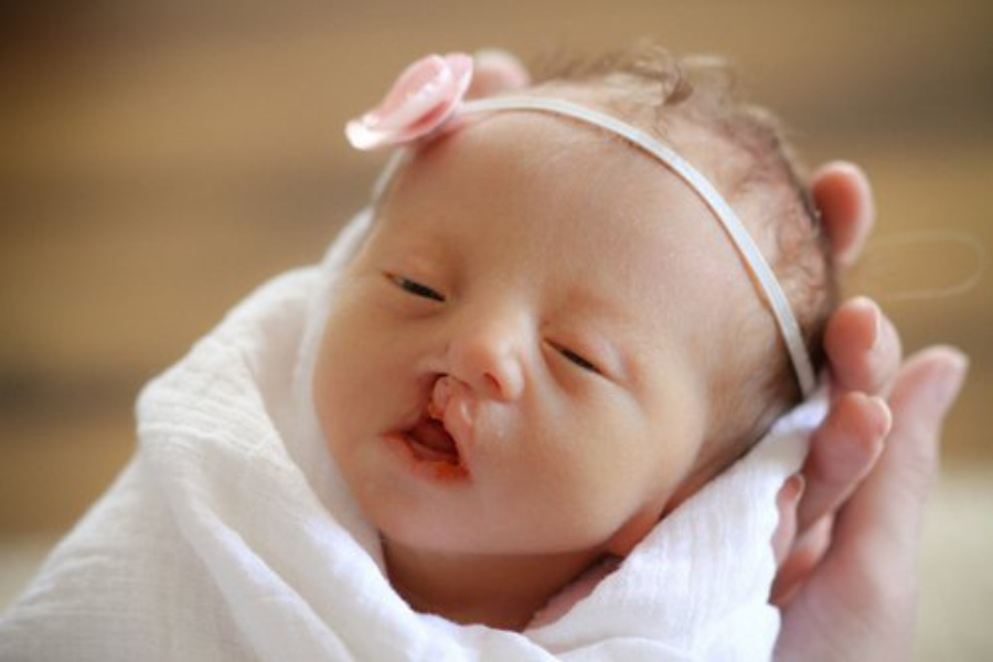 hoi chung patau ho ham ech ivie 7a76cc35 8d30 4554 b5d6 a9eb2657b391