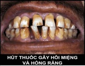 tac hai cua thuoc la 5