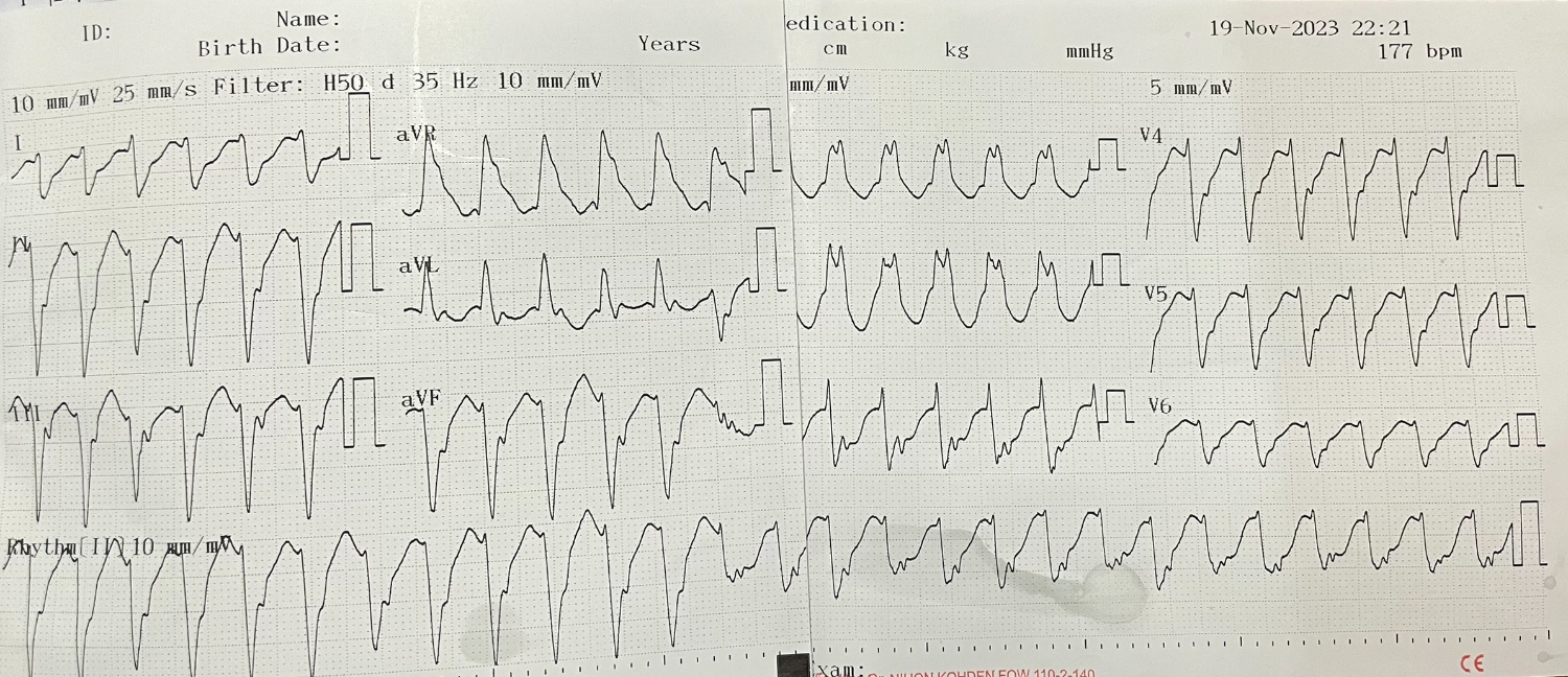 z4903722245160 b98b45d31da62cdfd20a756746d2c00a