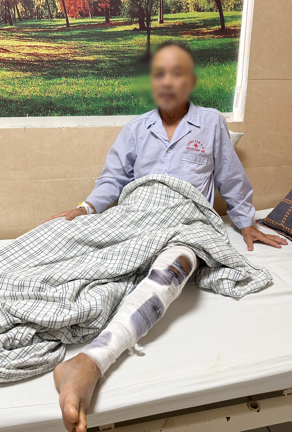 Bệnh nhân vượt hàng trăm kilomet để phẫu thuật kết hợp xương tại một Trung tâm Y tế huyện